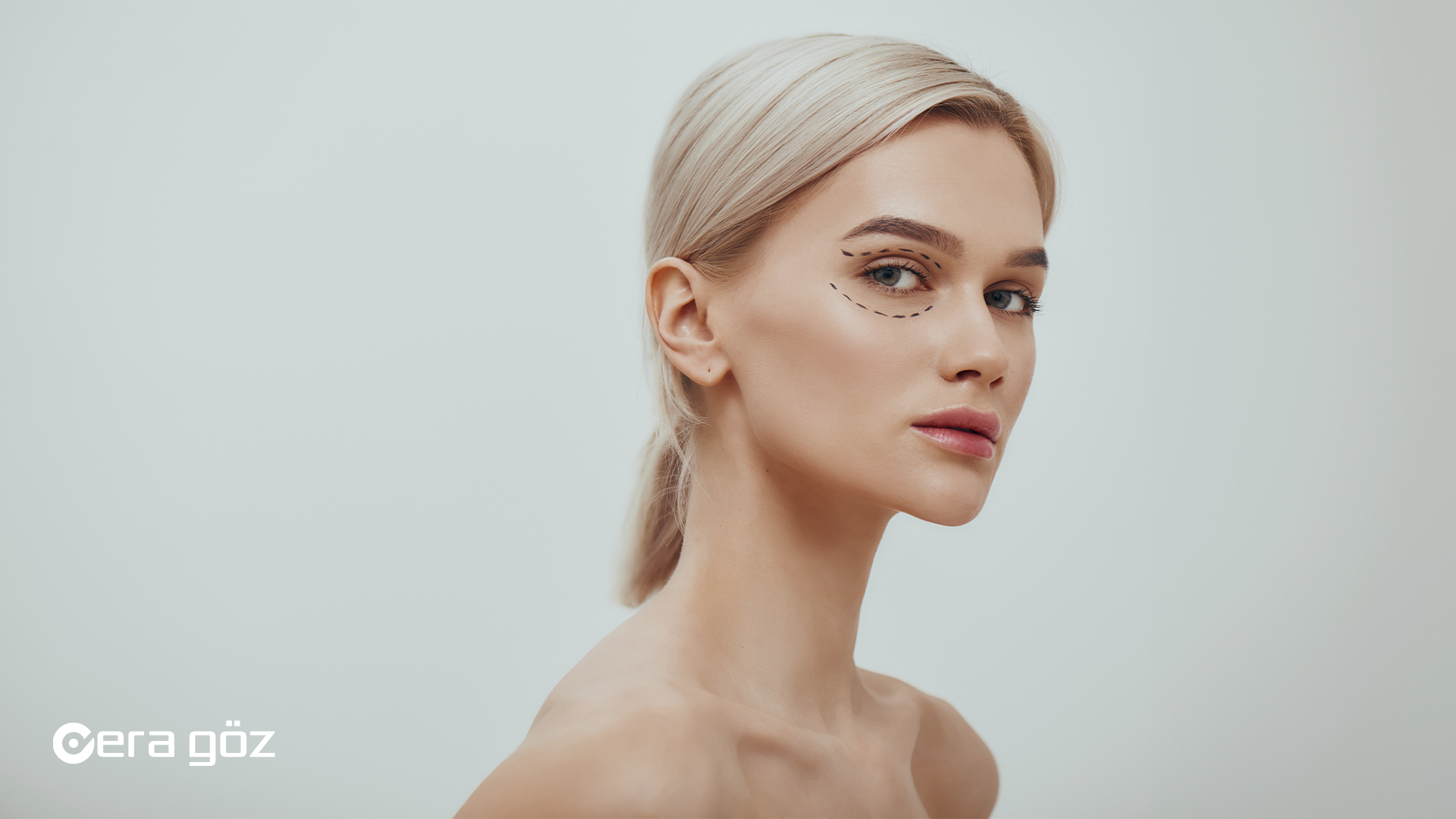 Blepharoplasty, Blepharoplasty Cost, Best Blepharoplasty Surgeons, Blepharoplasty Procedure, Upper Blepharoplasty, Lower Blepharoplasty, Blepharoplasty Before and After, Blepharoplasty Recovery, Blepharoplasty Risks, Blepharoplasty FAQs, Eyelid surgery, Eye bag removal, Upper eyelid lift, Lower eyelid lift, era göz, era goz, era eye hospital, era goz eye hospital, eye surgery in turkey, eye surgery, lasik eye surgery antalya