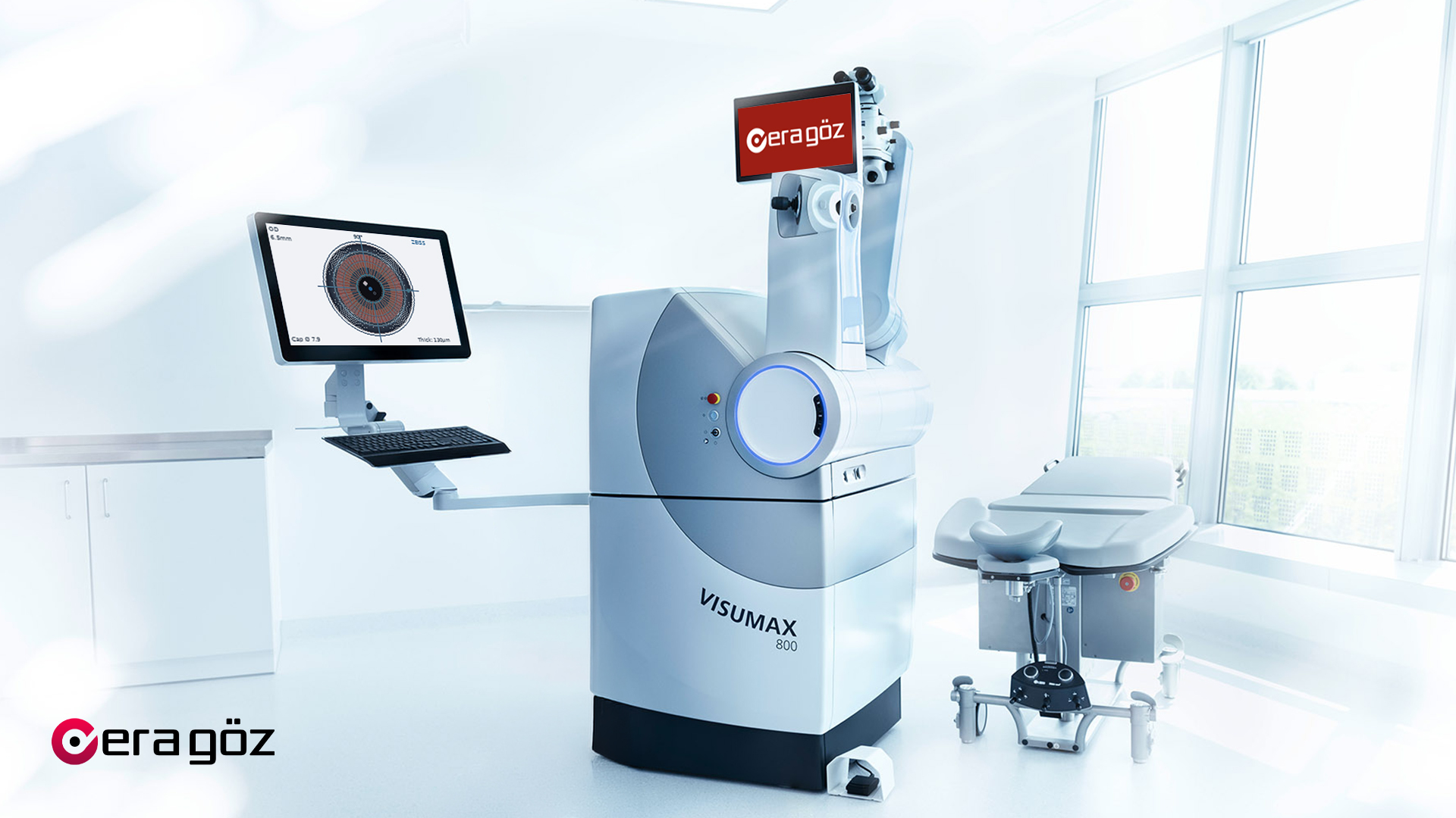 SMILE Pro Laser Eye Surgery in Turkey